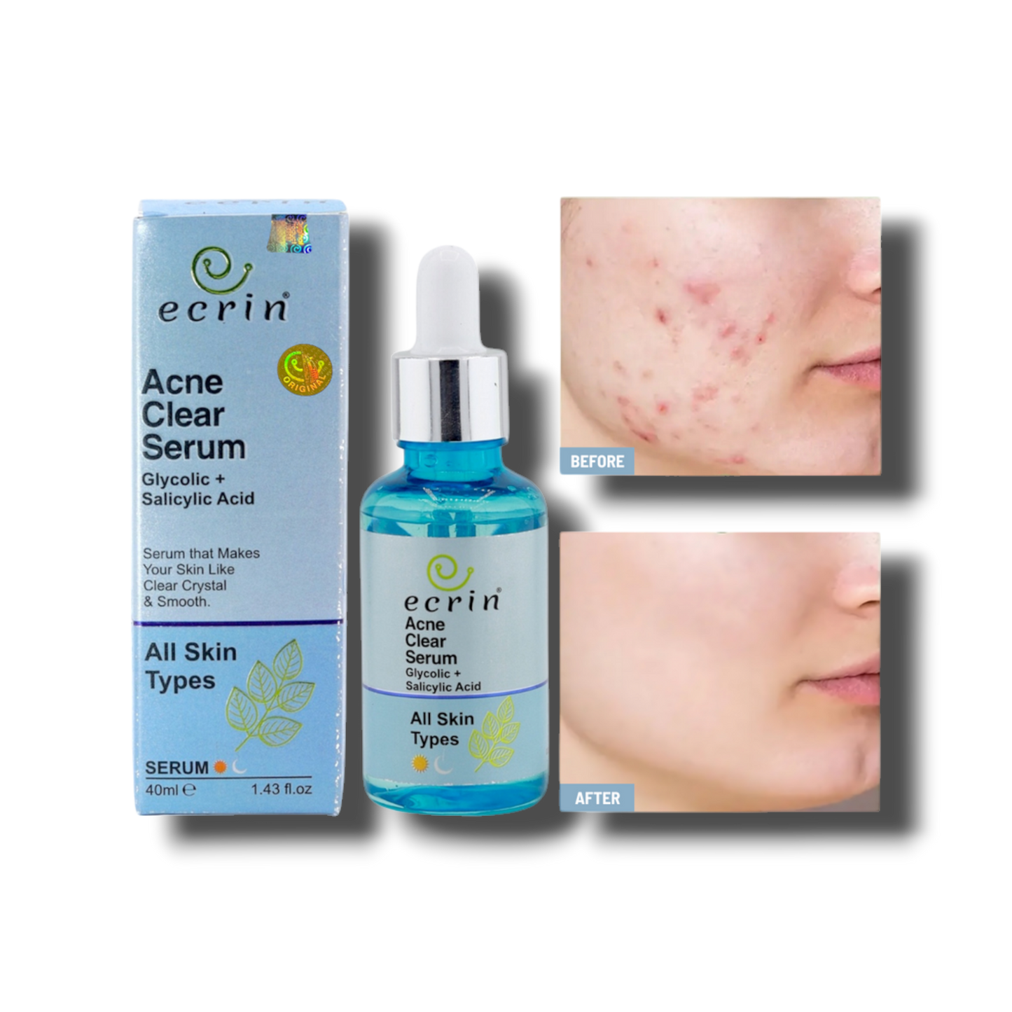 Ecrin acne clear serum